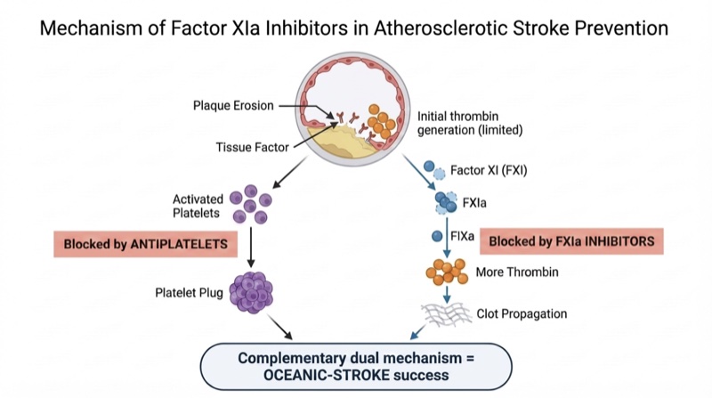 Mechanism of Factor XIa inhibitors in atherosclerotic stroke prevention